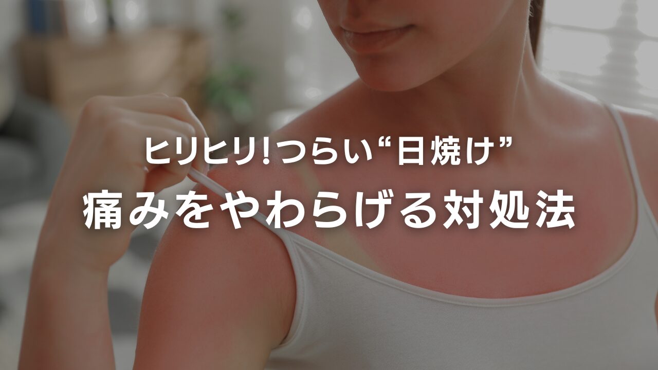 日焼けがつらい！痛みを和らげる対処法と予防法ガイド